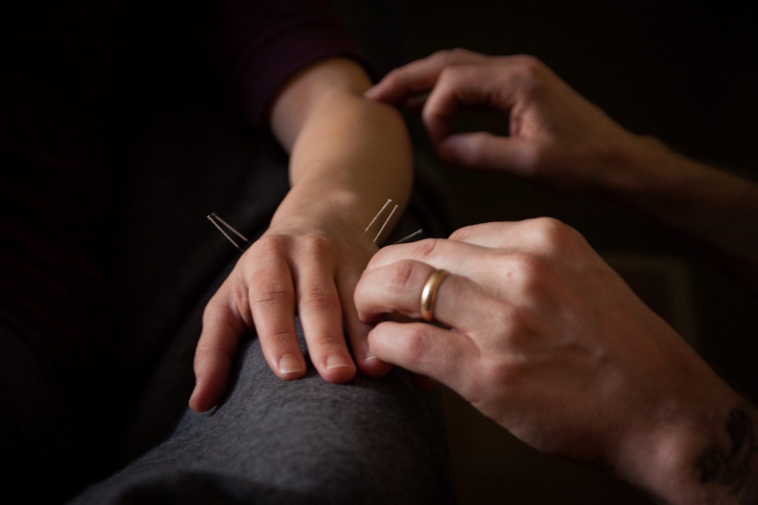 Individual receiving treatment at OPEN Community Acupuncture